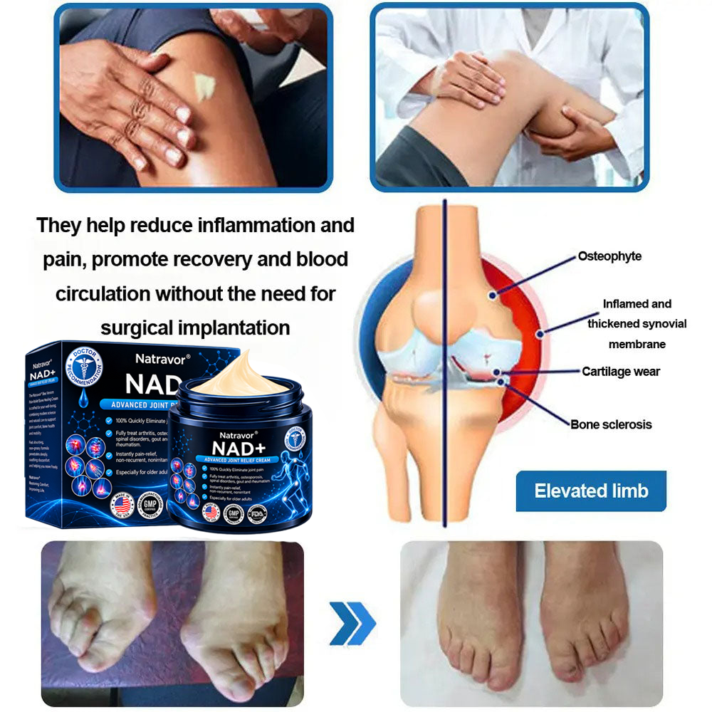 Official Store:  🦵𝐍𝐚𝐭𝐫𝐚𝐯𝐨𝐫™ NAD+ Advanced Anti-Aging Joint Relief Cre am (Specially for mature adults & recommended for daily joint care)🔥𝑳𝒂𝒔𝒕 𝒅𝒂𝒚 𝒑𝒓𝒐𝒎𝒐𝒕𝒊𝒐𝒏 7𝟎% 𝒐𝒇𝒇