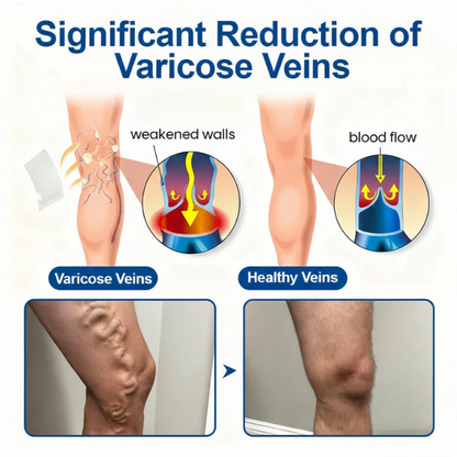 🏆🏆🇬🇧👨‍⚕️✅Natravor® VeinEase Microneedle Care Patch⚡Instant Relief, Long-Term Results