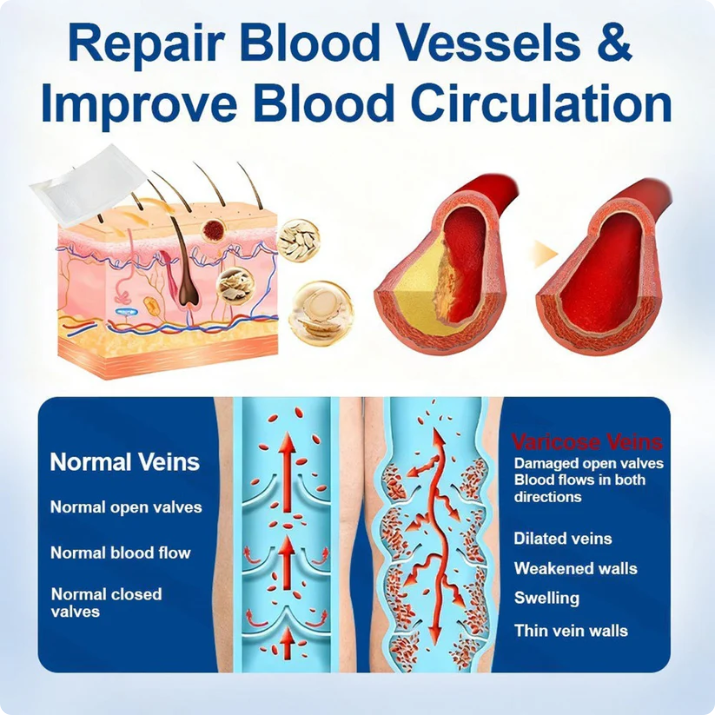 🏆🏆🇬🇧👨‍⚕️✅Natravor® VeinEase Microneedle Care Patch⚡Instant Relief, Long-Term Results