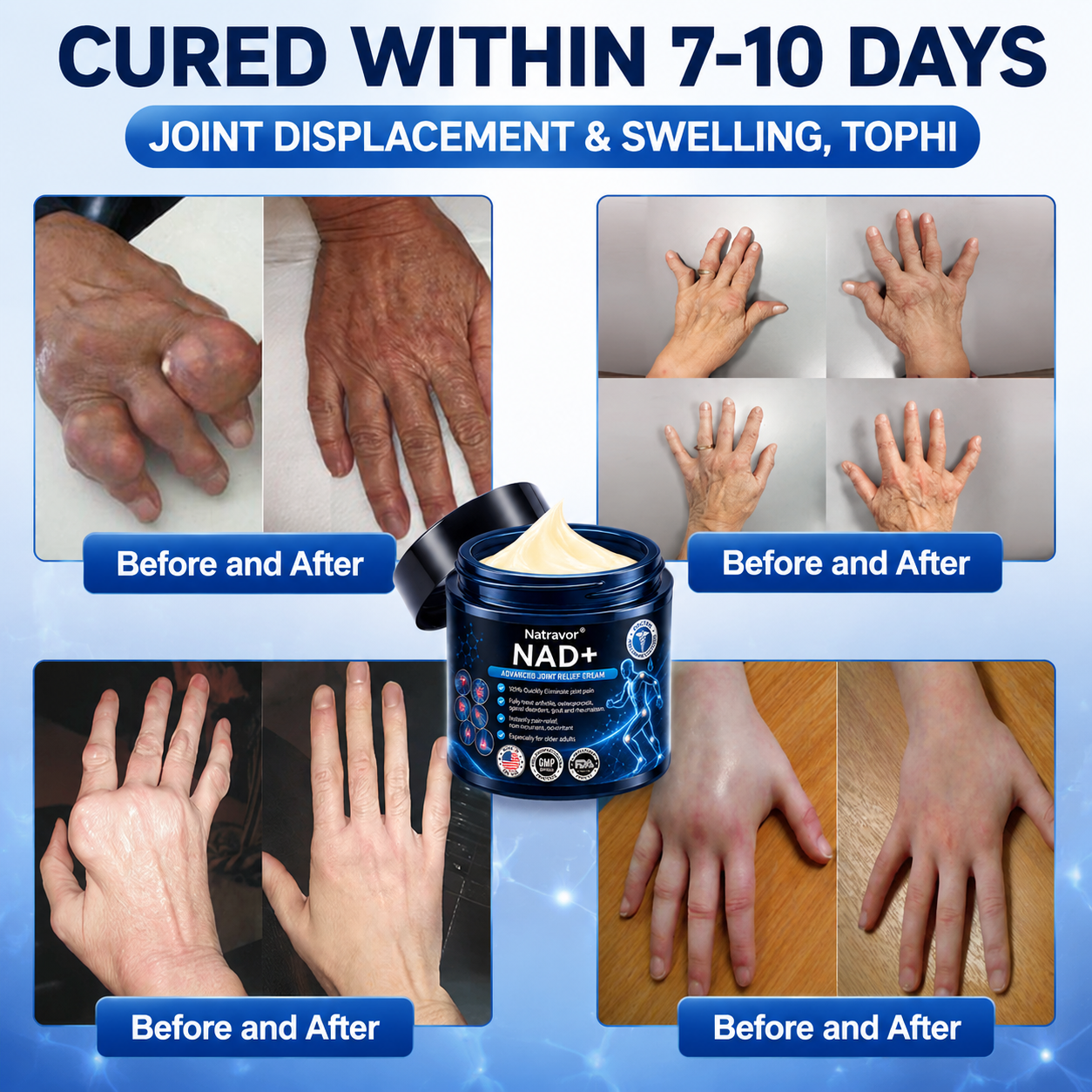 Official Store:  🦵𝐍𝐚𝐭𝐫𝐚𝐯𝐨𝐫™ NAD+ Advanced Anti-Aging Joint Relief Cre am (Specially for mature adults & recommended for daily joint care)🔥𝑳𝒂𝒔𝒕 𝒅𝒂𝒚 𝒑𝒓𝒐𝒎𝒐𝒕𝒊𝒐𝒏 7𝟎% 𝒐𝒇𝒇