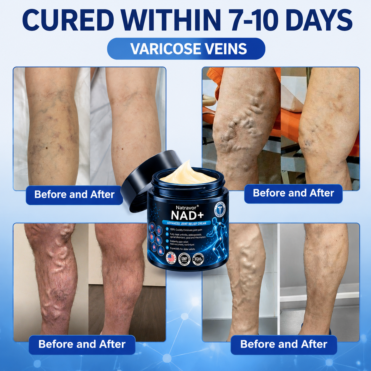 Official Store:  🦵𝐍𝐚𝐭𝐫𝐚𝐯𝐨𝐫™ NAD+ Advanced Anti-Aging Joint Relief Cre am (Specially for mature adults & recommended for daily joint care)🔥𝑳𝒂𝒔𝒕 𝒅𝒂𝒚 𝒑𝒓𝒐𝒎𝒐𝒕𝒊𝒐𝒏 7𝟎% 𝒐𝒇𝒇