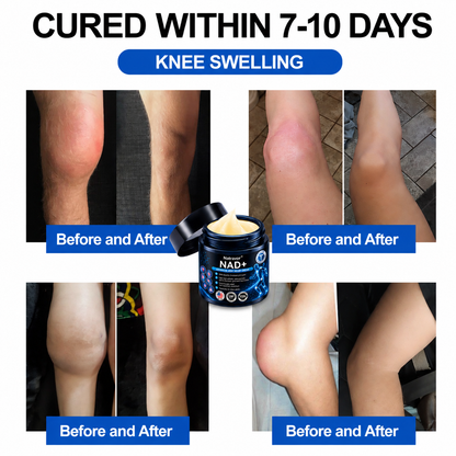 Official Store:  🦵𝐍𝐚𝐭𝐫𝐚𝐯𝐨𝐫™ NAD+ Advanced Anti-Aging Joint Relief Cre am (Specially for mature adults & recommended for daily joint care)🔥𝑳𝒂𝒔𝒕 𝒅𝒂𝒚 𝒑𝒓𝒐𝒎𝒐𝒕𝒊𝒐𝒏 7𝟎% 𝒐𝒇𝒇